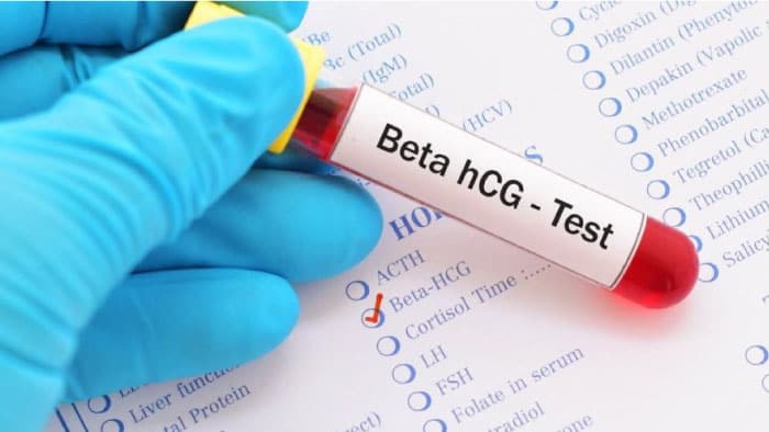 Gebeliğin 4. Haftasında Beta HCG Değeri