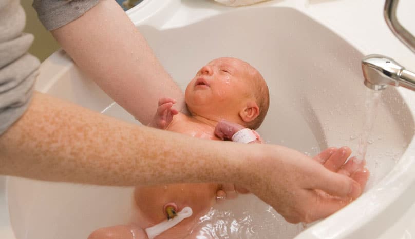 Yenidoğan bebeklerde banyo, göbek kordonu düşmeden yaptırılabilir mi?