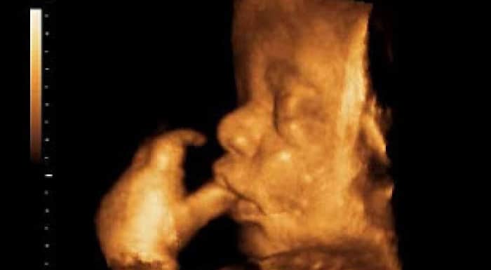 35 Haftalık Gebelik Bebek Görüntüsü