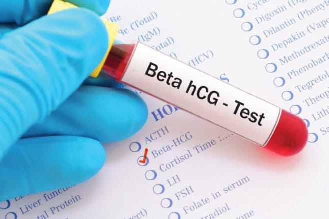 Gebelik Hormonu Beta HCG Nedir?