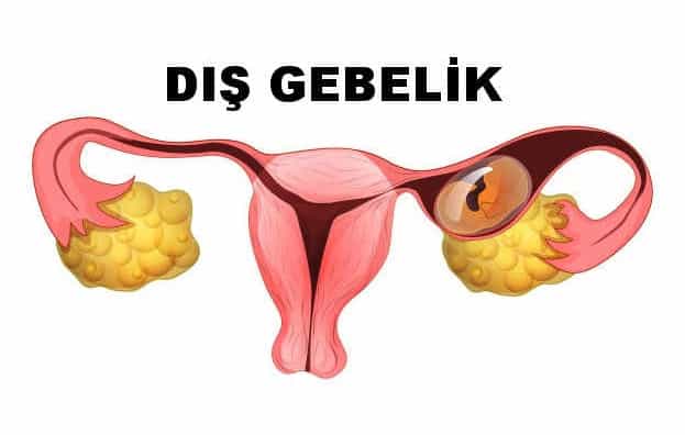 rüyada ev boşaltmak eryaman günlük ev kiralama