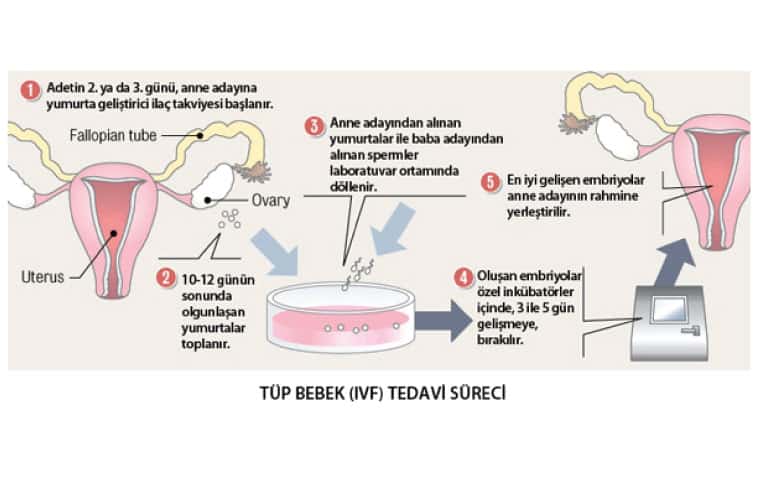 Tüp Bebek Tedavisi Aşamaları